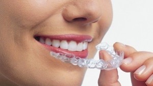 Invisalign_Trio1